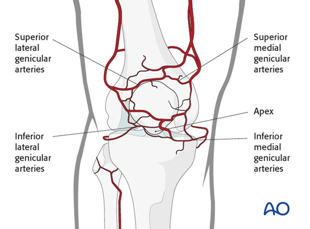 mid axial longitudinal approach