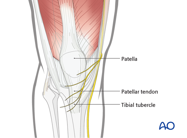 mid axial longitudinal approach