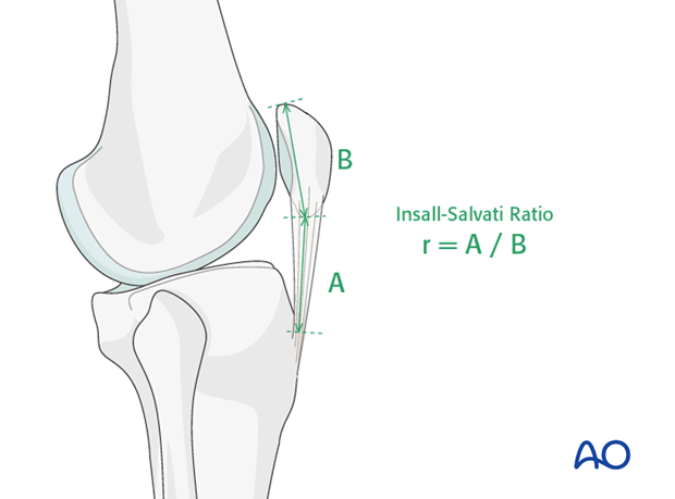 suture repair