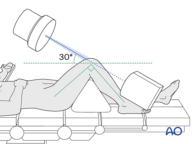 Positioning for optimal skyline view