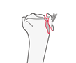 proximal tibia