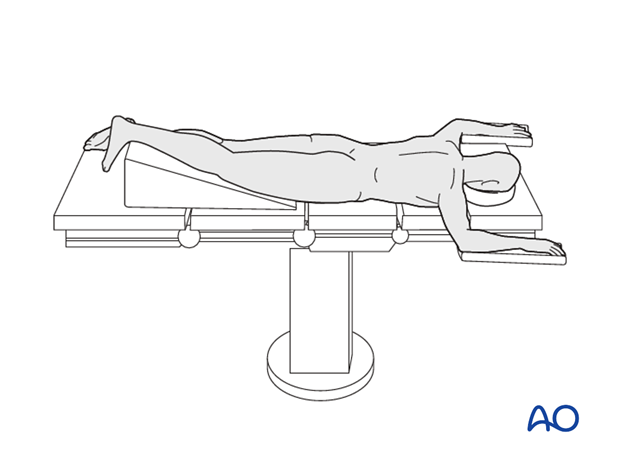 prone position