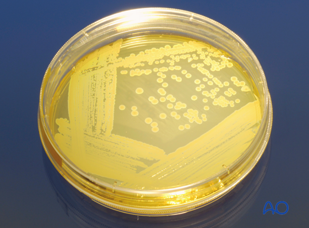 classifications of wound infection