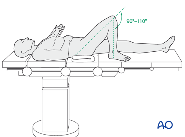 supine position for nailing