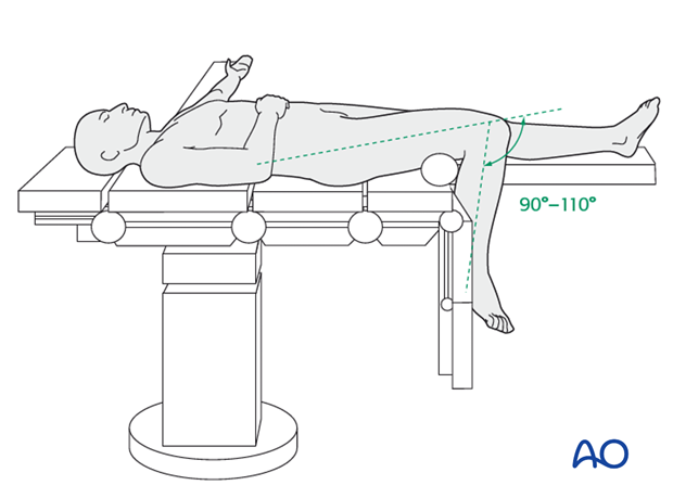 supine position for nailing