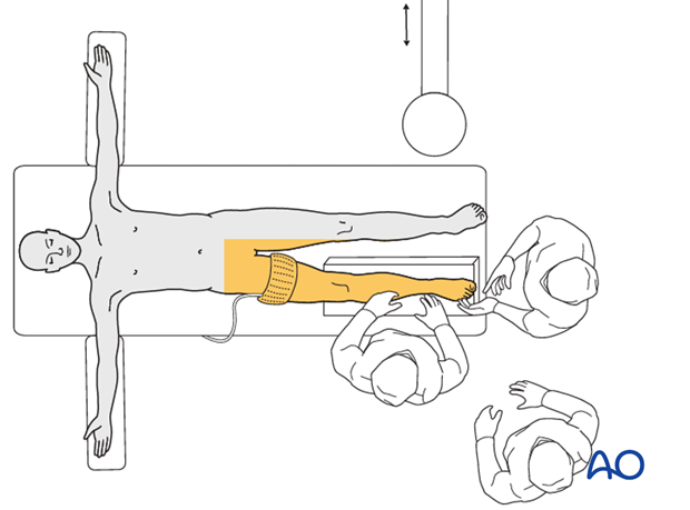 supine position