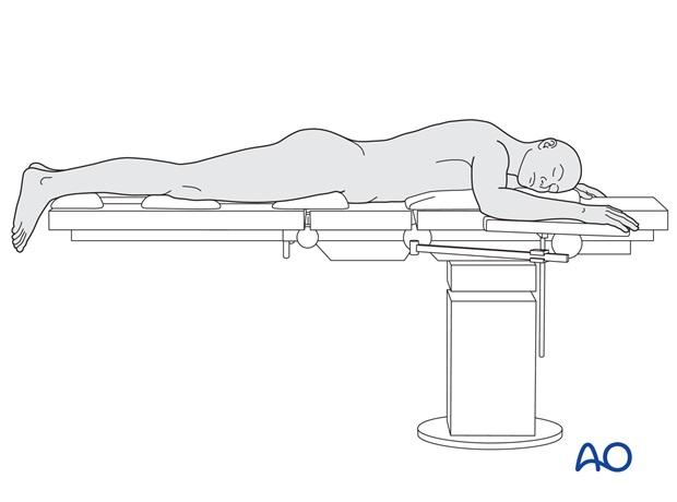 prone positioning