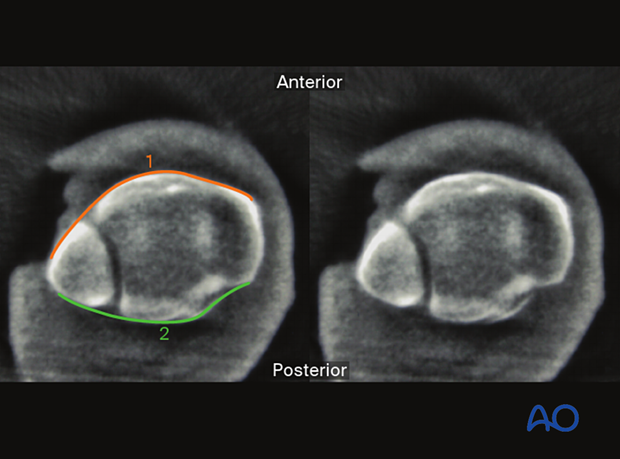 Intraoperative imaging