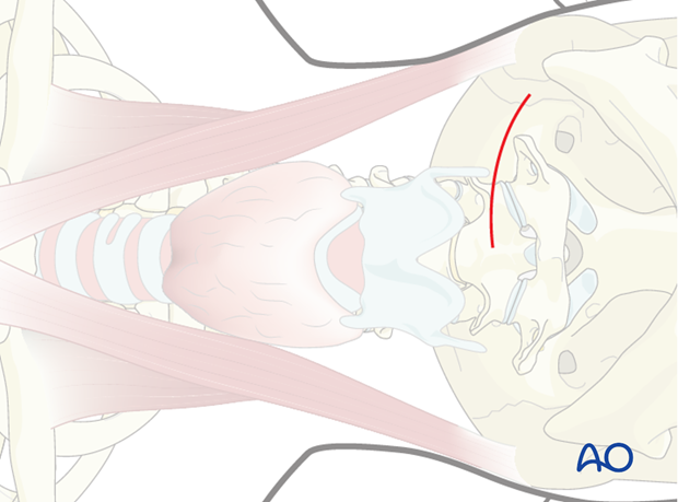 anterior access to c1t2