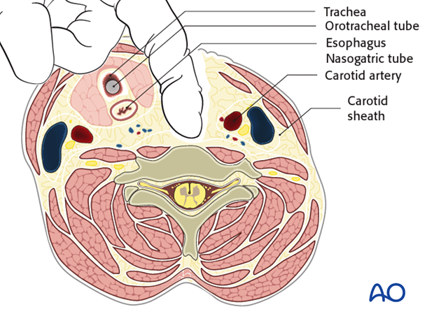 anterior access to c1t2