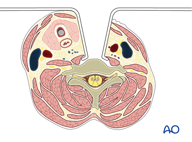 anterior access to c1t2