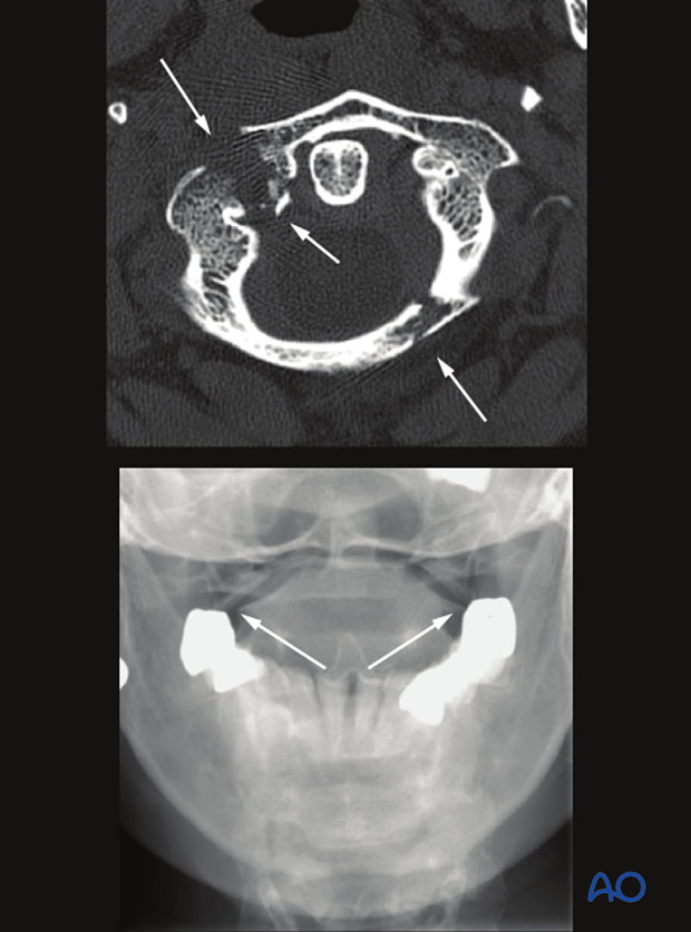 patient examination radiological evaluation xr ct mri