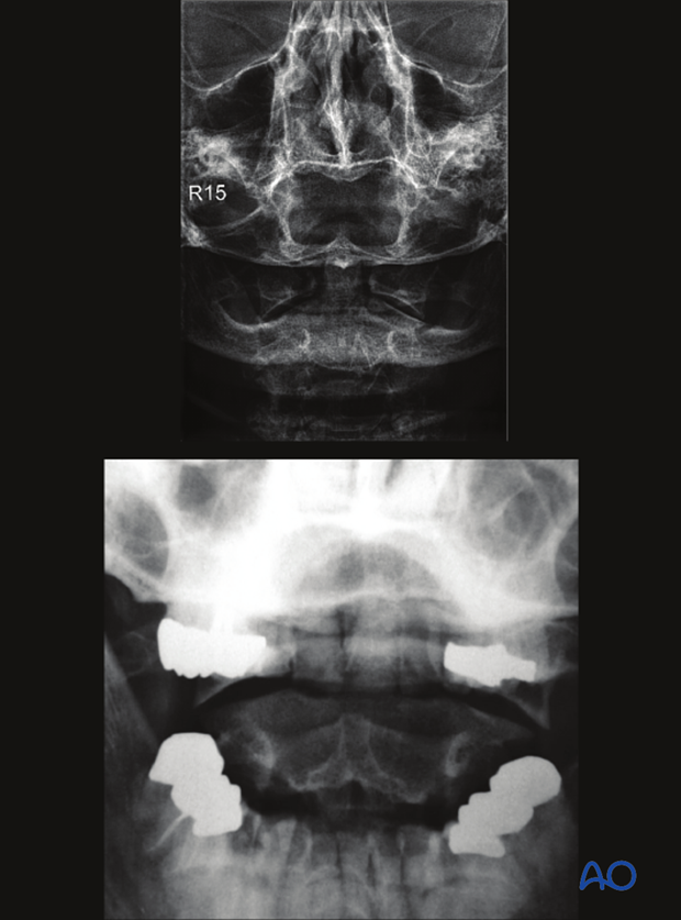 patient examination radiological evaluation xr ct mri