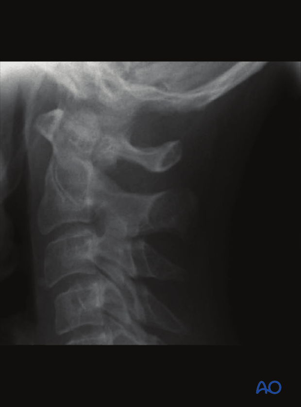 patient examination radiological evaluation xr ct mri