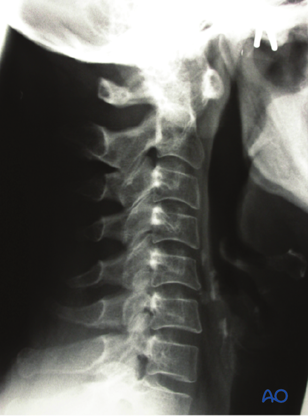 patient examination radiological evaluation xr ct mri