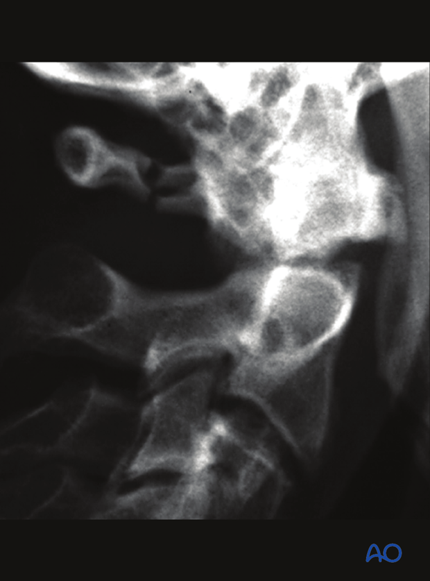 patient examination radiological evaluation xr ct mri