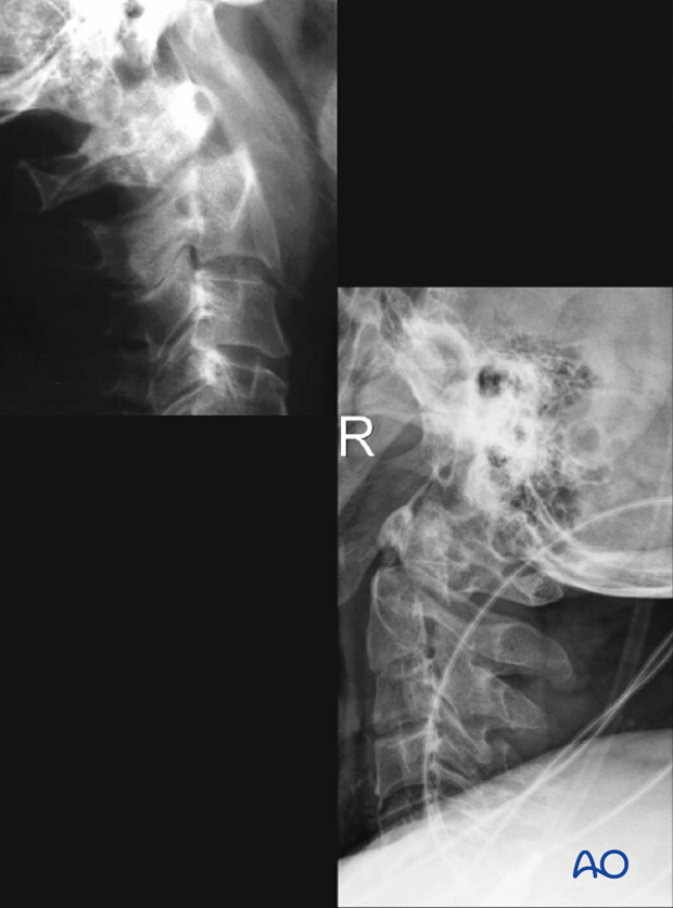 patient examination radiological evaluation xr ct mri