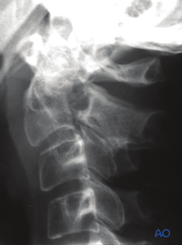 patient examination radiological evaluation xr ct mri