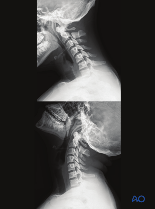 patient examination radiological evaluation xr ct mri