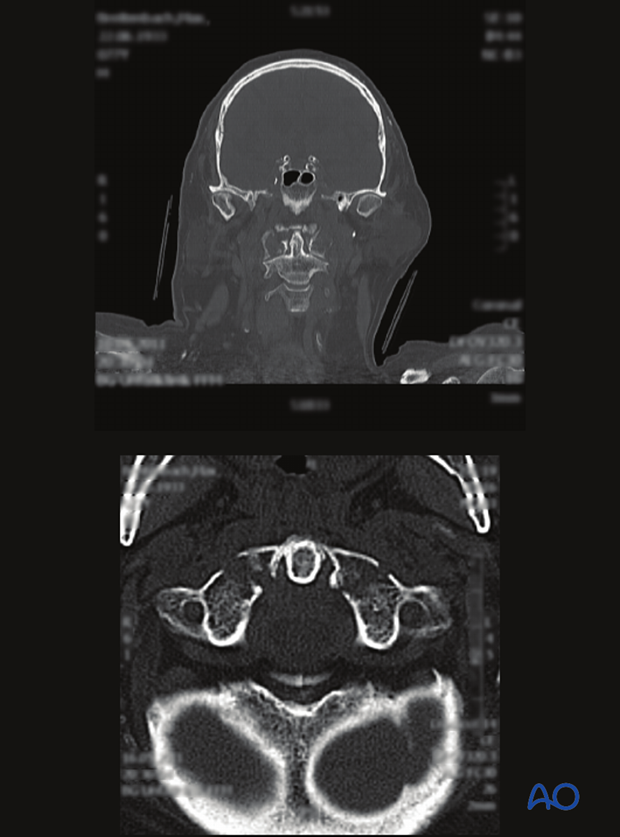 patient examination radiological evaluation xr ct mri