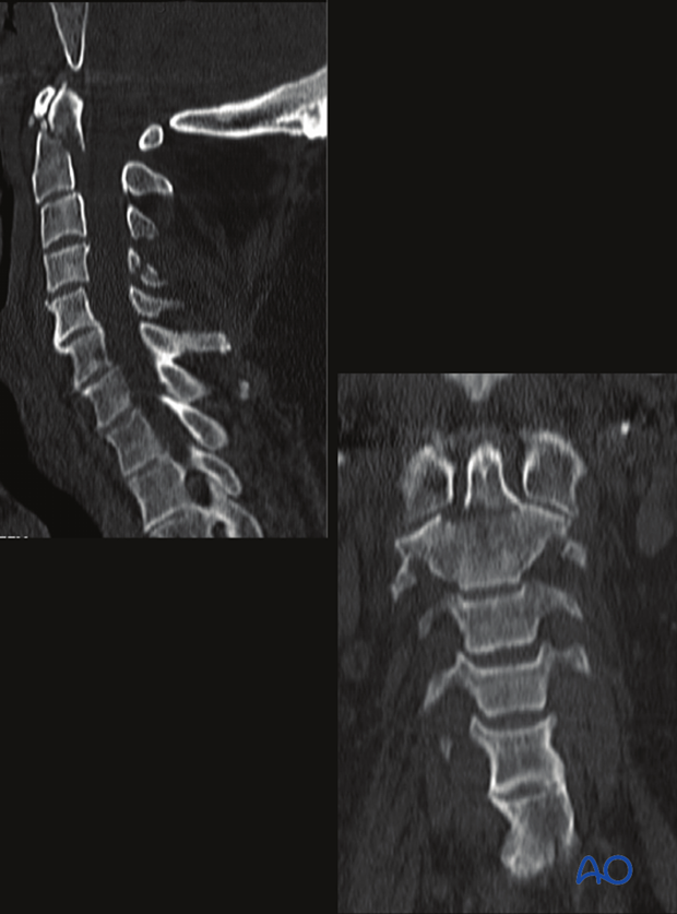 patient examination radiological evaluation xr ct mri