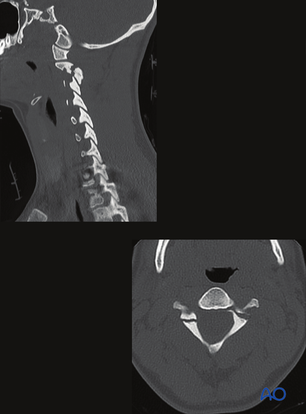 patient examination radiological evaluation xr ct mri