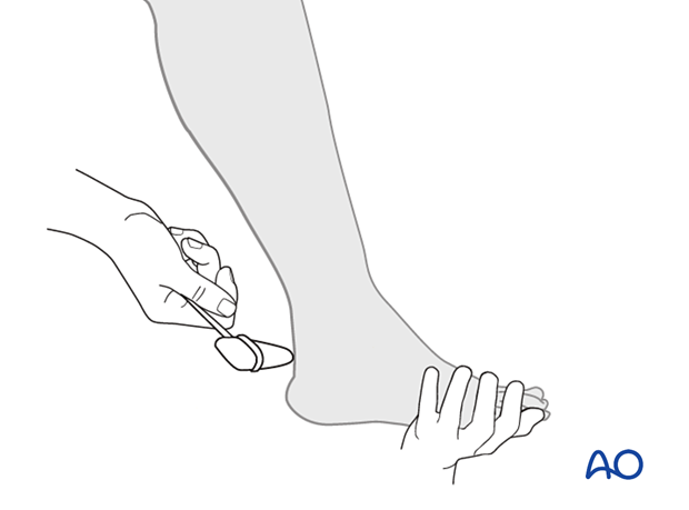 patient examination neurological evaluation