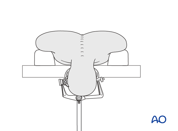 prone position