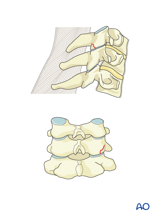 classification