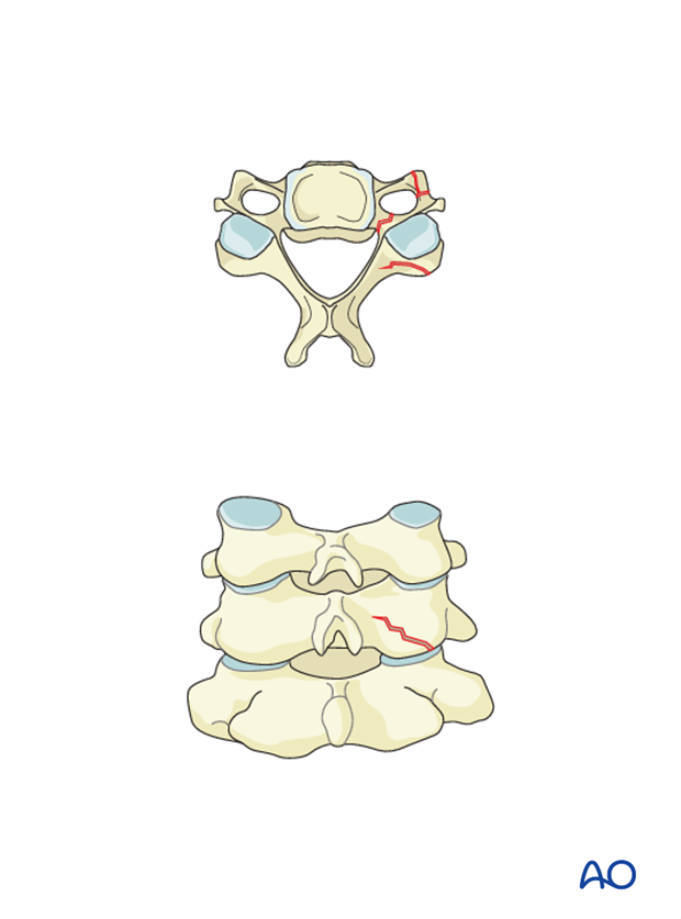 classification