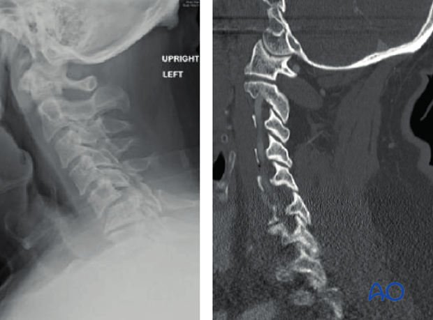 postoperative deformities