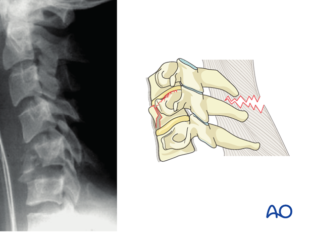 postoperative deformities