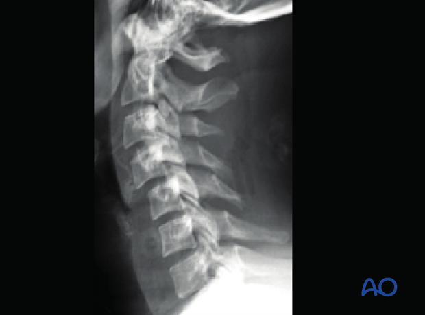 postoperative deformities