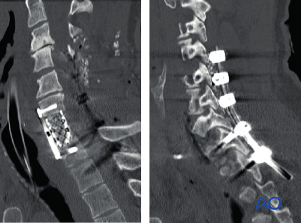 postoperative deformities