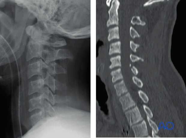 postoperative deformities