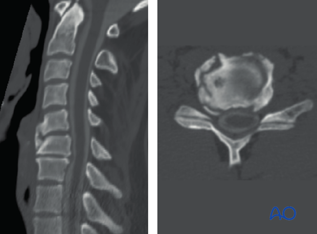 postoperative deformities