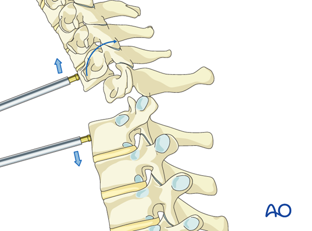 postoperative deformities