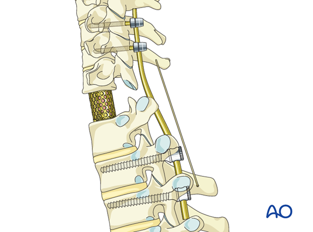 postoperative deformities