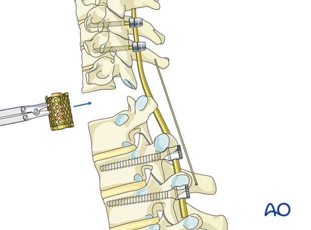 postoperative deformities