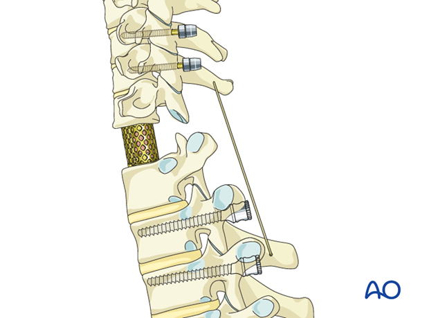 postoperative deformities