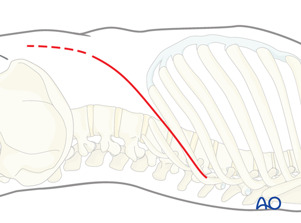 Left sided thoracolumbar junction approach (T10-L2)