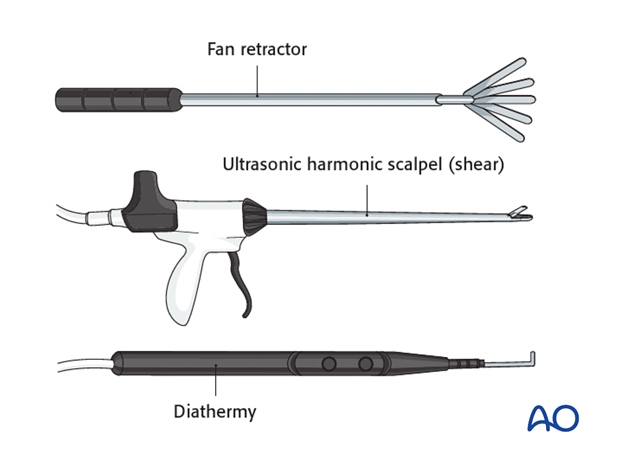 Thoracic and lumbar fractures: Minimally invasive right sided thoracic approach (T4-T10)