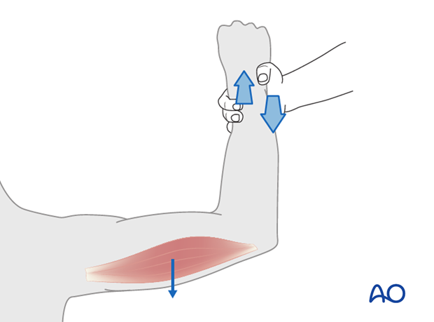 Thoracic and lumbar fractures: Patient examination - neurological evaluation