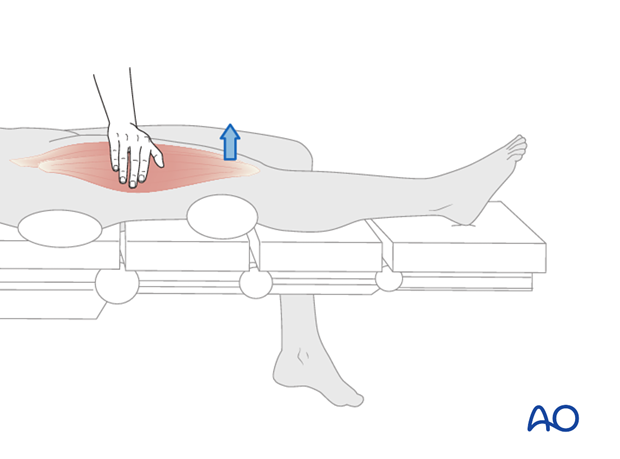 Thoracic and lumbar fractures: Patient examination - neurological evaluation