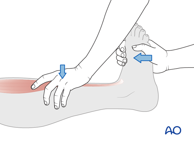 Thoracic and lumbar fractures: Patient examination - neurological evaluation