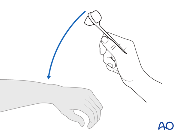 Thoracic and lumbar fractures: Patient examination - neurological evaluation