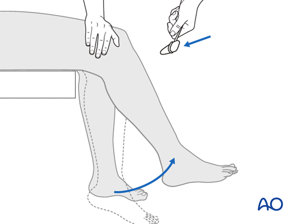 Thoracic and lumbar fractures: Patient examination - neurological evaluation