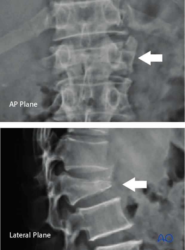 Radiological evaluation