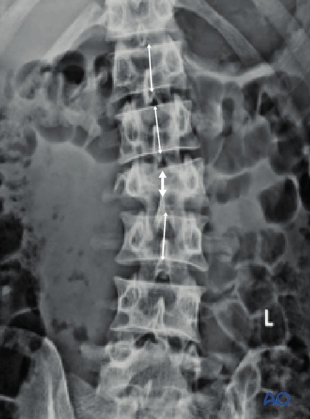 Patient Examination: Radiological evaluation (XR,CT, MRI)