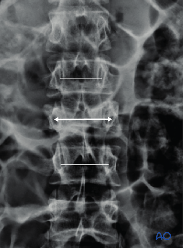 Patient Examination: Radiological evaluation (XR,CT, MRI)